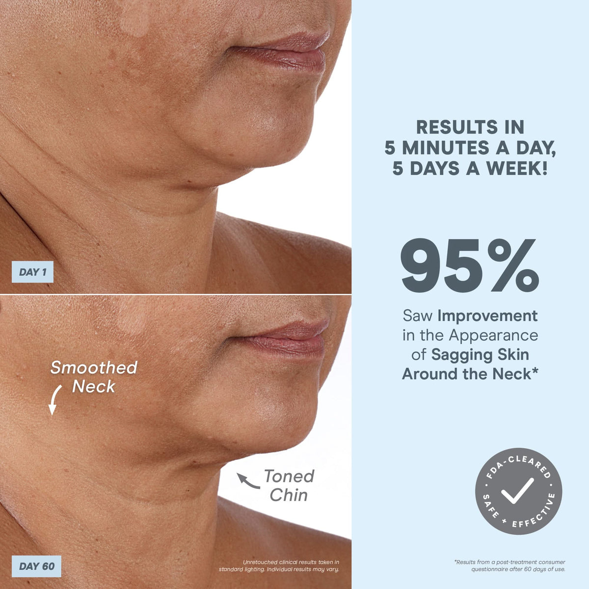 Nuface: MINI+ Facial Toning Device (Purple)